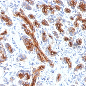 CFTR (Cystic Fibrosis Transmembrane Conductance Regulator); Clone CFTR/1341 (Concentrate)